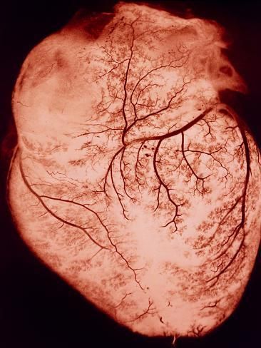 size: 16x12in Photographic Print: Heart with Arteries by Science Photo Library : Sustained Investigation, The Human Heart, Science Photos, Anatomical Heart, Human Heart, Beating Heart, Wow Art, Blood Vessels, Photo Library