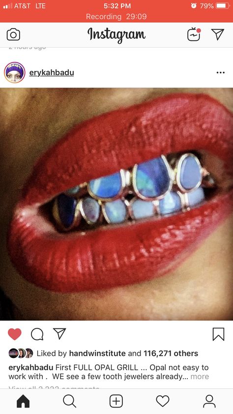 Word. Crystal Grill. Erykah Badu Grillz, Opal Grillz, Erykah Badu Style, Girl Grillz, Grillz Teeth, Diamond Teeth, Tooth Gems, Gold Grillz, Tooth Gem