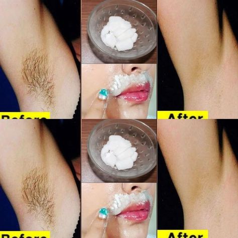 Dr. Barbara O'Neill Health Tips | Stop shaving !! This is how you should remove your pubic hair without shaving or waxing | Facebook Stop Shaving, Shaving Or Waxing, Nancy Fuller, Pubic Hair Removal, Natural Hair Removal, Hair Removal Remedies, Hair Removal Methods, Natural Sleep Remedies, How To Lighten Hair