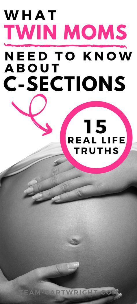 What you really need to know about having a c-section with twins. Get the honest experiences you will want to know before you give birth to twins. Twin mom tips on what to expect while having a twin c-section. This birth story is a must read during twin pregnancy to be prepared and ready. Twin birth story and twin c-section story. #twins #twinbirth #csection #twinpregnancy #newborntwins Team-Cartwright.com Increase Chances Of Twins, Twins Schedule, Feeding Twins, Sleeping Twins, Emergency C Section, Twin Life, Hospital Birth, Expecting Twins, Water Birth