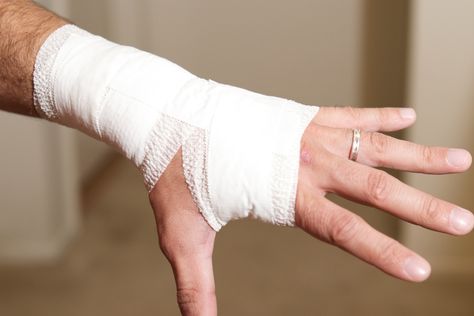 How To Wrap A Wrist With Athletic Tape | LIVESTRONG.COM Bandaged Hands, Wrist Injury, Prevent Blisters, Sports Tape, How To Wrap, Athletic Trainer, Athletic Training, Sports Injury, Wrist Wrap