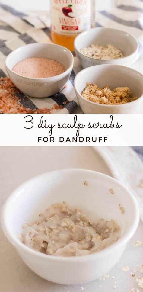 Scalp Scrub For Dandruff, Diy Scalp Scrub, Diy Hair Scrub, What Causes Dandruff, Dry Scalp Remedy, Hair Mask For Dandruff, Oils For Dandruff, Hair Detox, Dandruff Remedy