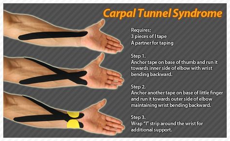 ARESPORTS Carpal Tunnel Exercises, Carpel Tunnel, Carpal Tunnel Relief, K Tape, Nyttige Tips, Kinesio Tape, Kt Tape, Kinesio Taping, Kinesiology Taping