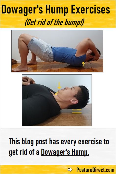 dowager's hump exercises Exercises For Dowagers Hump, Fix Dowagers Hump, Dowagers Neck Exercises, Dowagers Hump Correction Exercises, Dowagers Hump Correction, Neck Hump Correction, Hump Correction, Neck Bump, Dowagers Hump