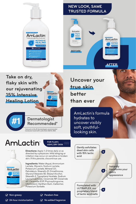 AmLactin Intensive Healing Body Lotion for Dry Skin – 14.1 oz Pump Bottle – 2-in-1 Exfoliator & Moisturizer with Ceramides & 15% Lactic Acid for Relief from Dry Skin (Packaging May Vary) Amlactin Body Lotion, Tranexamic Acid, Lotion For Dry Skin, Lactic Acid, Diy Hair Care, Flaky Skin, Body Healing, Body Cream, Dry Skin