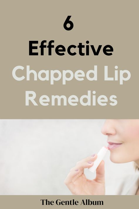 Do you have chapped lips? Here are some of the best chapped lip remedies so you can treat them quickly. The article will talk about the best chapsticks, lip scrubs, and lip sleeping masks for dry lips. #remedy #lips #lipbalm #getridofchappedlips Lip Remedies, Remedies For Chapped Lips, Dry Lips Remedy, Aloe Vera For Sunburn, Skincare Recommendations, Home Remedies For Allergies, Home Remedies For Warts, Warts Remedy, Sleeping Masks