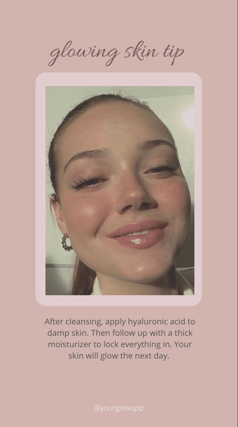 How To Do Slugging, Slugging Skin, Skin Hacks, 7th Grade, Skin Tips, Glow Up?, Hyaluronic Acid, Dry Skin, Glowing Skin