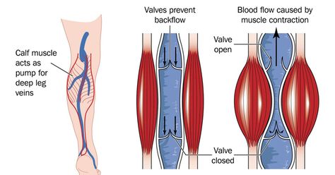 Is there anything more painful than a muscle cramp in the middle of the night? Leg cramps, often called Charlie horses, seem to strike when you are most relaxed and your body is healing. If you can get your leg to stretch out and relax, you can get a cramp to pass quickly. However, you … Nighttime Leg Cramps, Soleus Muscle, Calf Cramps, Leg Veins, Venous Insufficiency, Muscle Atrophy, Leg Cramps, Muscle Contraction, Healthy Body Weight