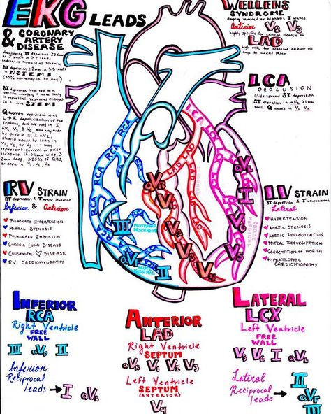 EKG leads and the coronary arteries...this plus my 2 other recent #EKG posts… Cardiology Study, Ekg Leads, Student Doctor, Paramedic School, Medical Student Study, Cardiac Nursing, Nursing School Survival, Nursing School Studying, Nursing School Tips