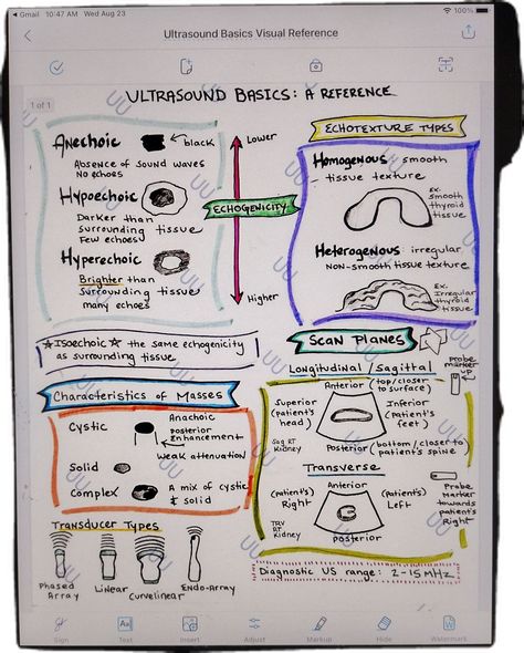 Handwritten Ultrasound Basics Visual Reference. 1 page    Geared towards new DMS Sonography students/anyone just starting to learn about ultrasound. Covers types of echogenicity, echotexture types, characteristics of masses, scan planes, transducer types, and the range for diagnostic ultrasound (a common class test and registry question!). This is a PDF ready to be downloaded to your device.  I don't accept returns, exchanges, or cancellations.  But please contact me if you have any problems wit Cardiovascular Sonography Student, Medical Sonography Aesthetic, Ultrasound Tech Student, Ultrasound Tech Notes, Sonography Student Study, Sonography Notes, Ultrasound Aesthetic, Diagnostic Sonography, Sonography Humor