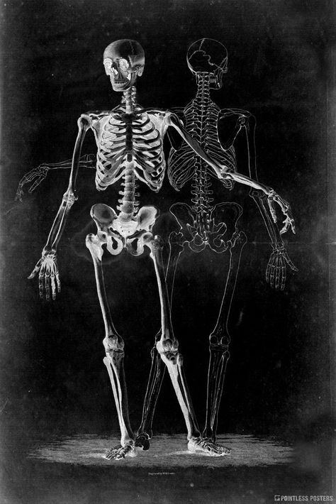 Two Skeletons On Black Gothic Poster Two Skeletons, Gothic Landscape, Goth Room, Gothic Poster, Medical Drawings, Skeleton Drawings, Pretty Backgrounds, Skeleton Art, Wallpaper Iphone Christmas