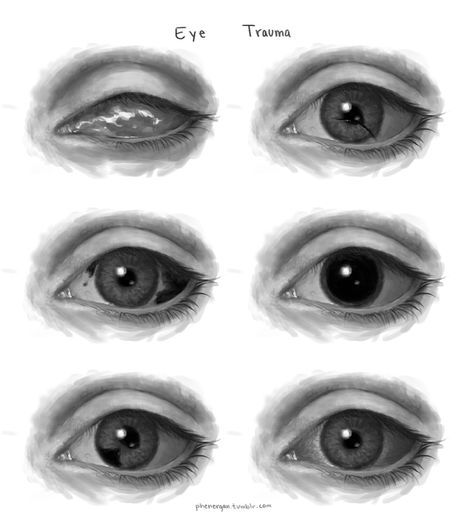 "Eyes" illustrations by DeviantArt user "God-Head" #eyes #illustration #reference #drawing Drawing Blind Eyes, Possessed Eyes Drawing, Blind Eyes Drawing Reference, Blind Eyes Art, How To Draw Blind Eyes, High Eyes Drawing, Mad Eyes Drawing, Blind Eyes Drawing, Human Eye Drawing