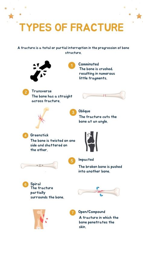 Orthopedic Study Notes, Fractures Nursing, Fracture Types, Nursing Respiratory, Urgent Care Nurse, Anatomy Diagrams, Types Of Injuries, Ortho Nurse, Orthopedic Nurse