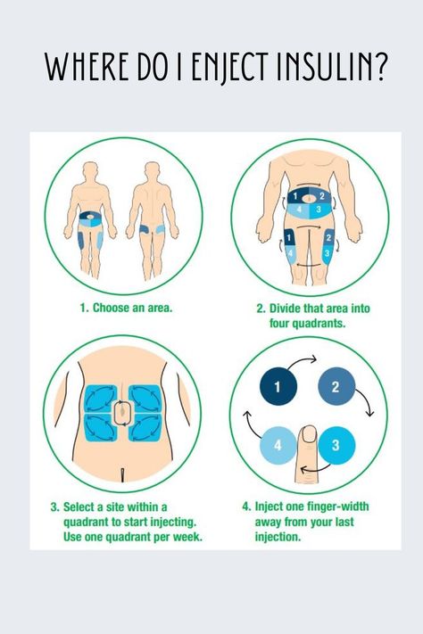 Changing the injection site is one of the key steps to speeding up insulin absorption. Different injection sites have different absorption rates. It is best not to move injection sites daily from one part of the body to another. Instead, go to different places in the area being used. read more: https://www.healthnavigator.org.nz/medicines/i/insulin-injection-sites/ Insulin Injection Sites, Insulin Injection, Injection Sites, Nurse Skills, Insulin Therapy, Types Of Insulin, Lower Blood Sugar, Diet And Nutrition, Losing Me