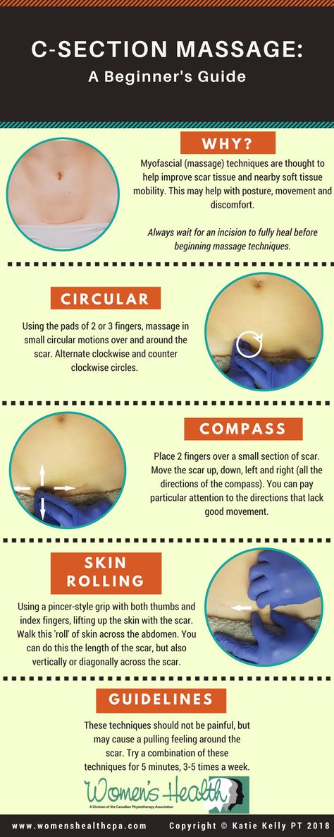 Scar Massage, C Section Scar, C Section Scars, Medicine Tips, Cold Sores Remedies, Natural Sleep Remedies, Natural Cold Remedies, Natural Cough Remedies, Cough Remedies