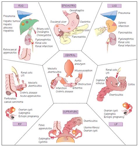 GI Assessment Gi System Nursing, Gastrointestinal Nursing, Nursing Apps, Pass Nursing School, Medications Nursing, Nursing Cheat, Med Surg Nursing, Nursing School Essential, Nursing Study Guide