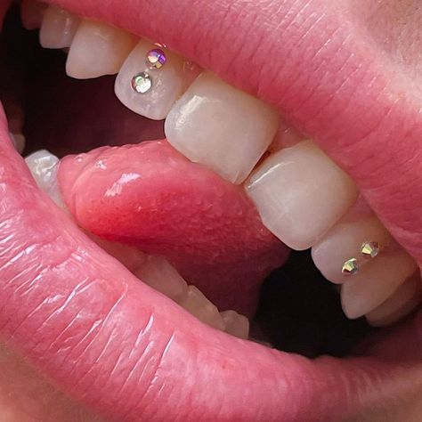 🦷DIY Tooth Gem Kits &Crystals💓 on Instagram: “Double mermaid gems ? Love it! Get your DIY kit now, before it’s sold out again 🦷💎💘 big thanks to @lunaantoniaa for sharing this cute look…” Simple Teeth Gem Ideas, Front Tooth Gems, Tooth Gems Placement Ideas, Tooth Gems Front Teeth, Simple Tooth Gem Designs, Tooth Gems On Gap Teeth, Cute Tooth Gem Ideas, Cute Tooth Gems, Basic Tooth Gem Ideas