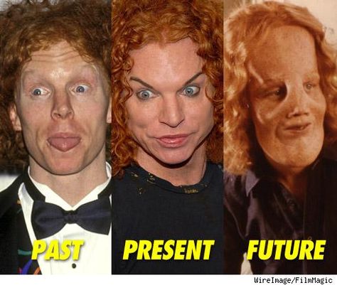 Carrot Top's Evolution Ginger Humor, Surgery Humor, Bad Plastic Surgeries, Plastic Surgery Gone Wrong, Carrot Top, Celebrity Plastic Surgery, Past Present Future, Cosmetic Surgery, Funny People