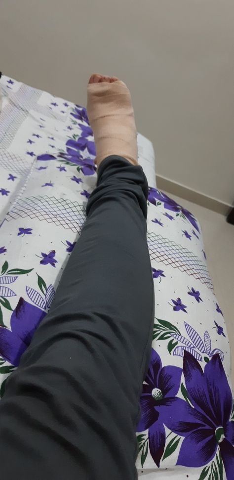 Leg Injury Insta Story, Hospital Leg Injury, Back Injury Snapchat, Football Injury Snapchat, Fractured Leg Snap, Leg Photo Snapchat, Hand Plaster Fracture Snap, Hand Fracture Fake Story, Leg Accident Real Pic In Hospital