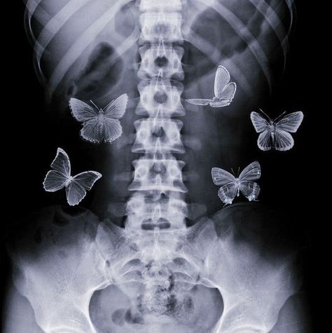 Butterfly In My Stomach, Bag Essentials School, Butterflies In Stomach, Butterfly Stomach, Butterflies In The Stomach, Butterflies In Your Stomach, Everyday Bag Essentials, Butterflies In My Stomach, School Bag Essentials