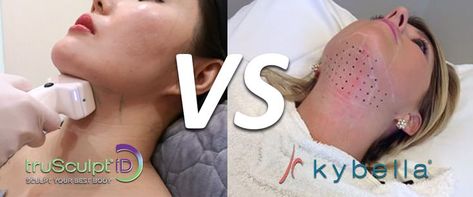 Are you thinking about getting Trusculpt or Kybella for Chin Fat Removal? Learn the diffrences in this article. Double Chin Reduction, Chin Reduction, Double Chin Removal, Body Flush, Cool Sculpting, Cosmetic Treatments, Lower Belly, Fat Removal, Fat Reduction