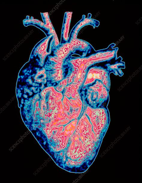 Pulse Aesthetic, Heart Scan, Anatomy Embroidery, Aortic Arch, Cool Screensavers, Heart Arteries, Heart Flow, Medical Images, Flatware Crafts