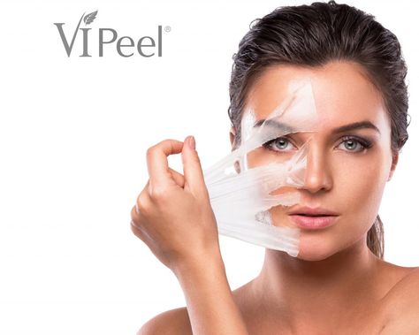 Chemical Peel Fort Myers | Facial Peel Naples Lemon On Face, Baking Soda For Hair, Peeling Facial, Blackhead Remedies, Honey Face Mask, Arm Workouts, Honey Face, Facial Peel, Get Rid Of Blackheads