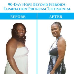 Fibroid Diet, Fibroid Uterus, Fibroid Surgery, Fibroid Tumors, Essence Festival, Polycystic Ovarian Syndrome, Medical School Essentials, Naturopathic Doctor, Natural Treatments