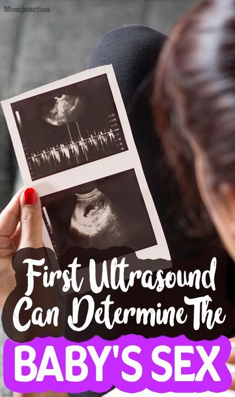 Baby Heart Rate Gender, 8 Weeks Pregnant Ultrasound, Ultrasound Boy Or Girl, Boy Ultrasound Pictures, Baby Gender Ultrasound, 8 Week Ultrasound, Ultrasound Gender Prediction, Boy Or Girl Prediction, Boy Ultrasound