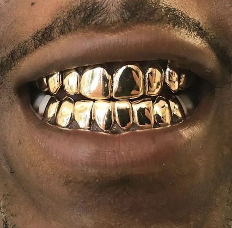 𝔉𝔬𝔩𝔩𝔬𝔴 𝖋𝖔𝖗 𝖒𝖔𝖗𝖊 𝖕𝖎𝖓𝖘🦋 Gold Slugs, Gold Teeth Grills, Mouth Grills, Teeth Aesthetic, Grillz Teeth, Diamond Grillz, Gold Grill, Diamond Teeth, Gold Grillz