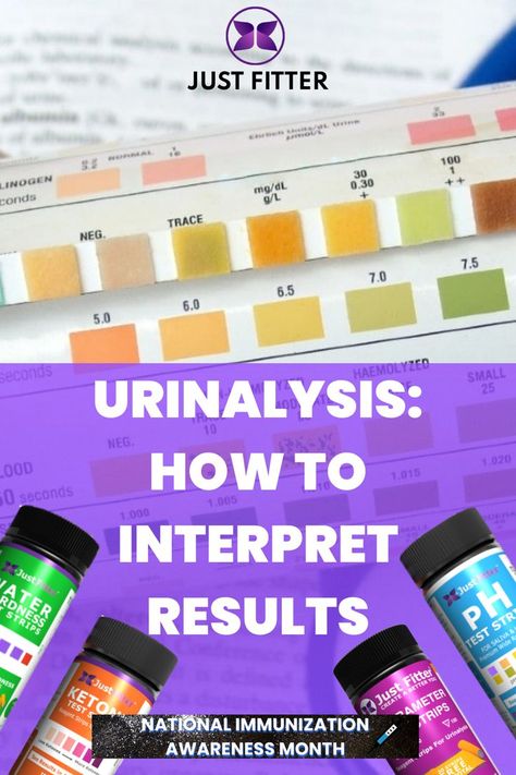 Urinalysis is an important screening and diagnostic tool, so here's how to interpret results. Read here:https://bit.ly/37eyBU9 #urinalysis #results #justfitter Create Awareness, Reading, 10 Things