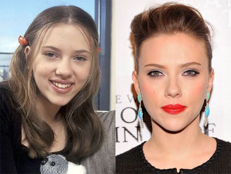 alllmost makes me want this too, I've got a pre -scar-jo nose-job nose ;) Scarlett Johansson, Before and After - Beauty Editor Ethnic Rhinoplasty, Hair Implants, Face Surgery, Rhinoplasty Before And After, Wide Nose, Perfect Nose, Celebrity Plastic Surgery, Celebrities Before And After, Breast Reduction