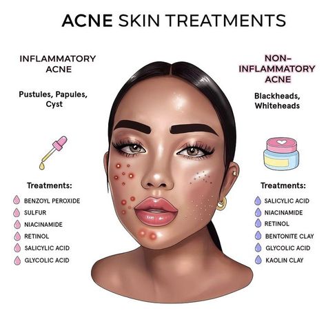 Best Skincare Products for Hyperpigmentation and Dark Spots Skin Treatments For Dark Spots Beauty Products, How To Clear Acne, Skincare Tips For Acne, Skincare Products For Hyperpigmentation, Products For Hyperpigmentation, Acne Tips, Mild Acne, Dry Skincare, Acne Prone Skin Care