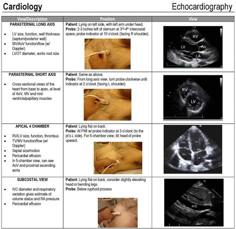 Sonography Notes Ultrasound, Diagnostic Medical Sonography Student Notes, Kids Pirate Crafts, Cardio Sonography, Medical Sonography Student, Sonography Notes, Sonography Student Study, Echo Sonography, Echo Ultrasound