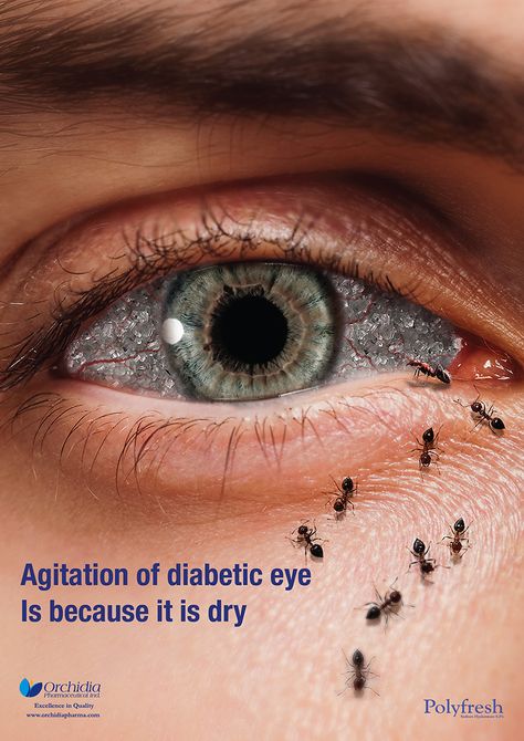 Interesting to see this eye drop ad- Rohto inspo Eye Creative Ads, Eye Poster Design, Eye Hospital Creative Ads, Eye Advertising, Advertising Campaign Design, Healthcare Advertising, Healthcare Ads, Eyes Poster, Eye Poster