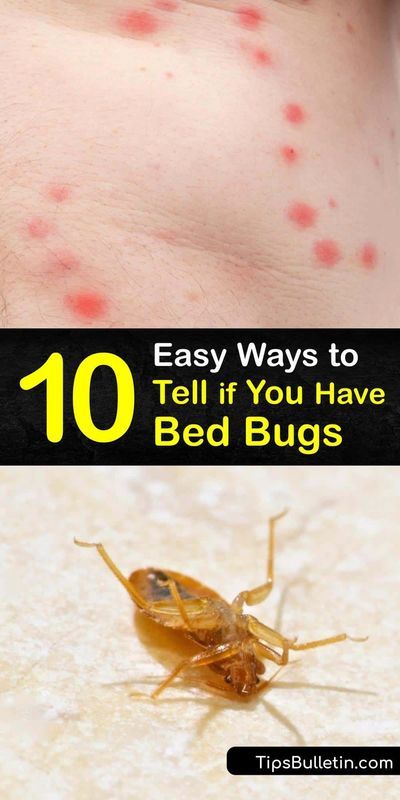 Bed Bug Bites Pictures, Bed Bug Trap, Signs Of Bed Bugs, Get Rid Of Bed Bugs, Bug Trap, Bug Activities, Easy Juice Recipes, Kill Bed Bugs, Vegan Probiotics