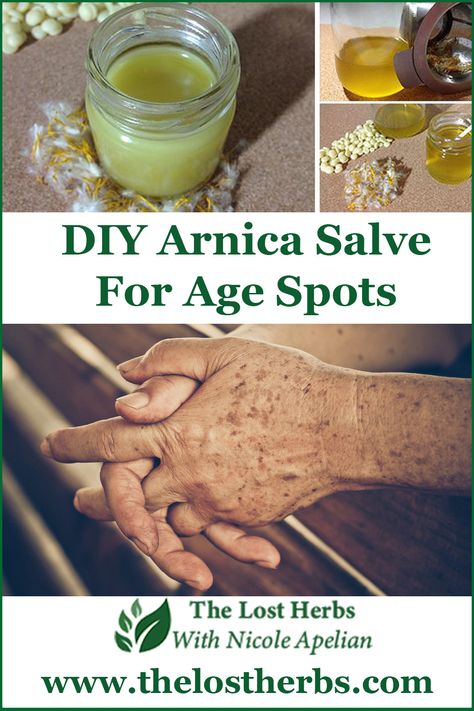 Arnica Flower Uses, Arnica Benefits Skin, Arnica Salve Recipe, Arnica Benefits, Herbal Preparations, Arnica Salve, Sickness Remedies, Arnica Oil, Acne Prone Skin Care