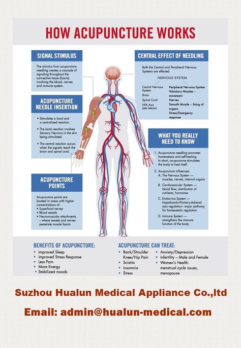 Acupuncture Points Chart, Acupuncture Needle, Acupuncture Benefits, Energy Healing Reiki, Energy Medicine, Acupuncture Points, Acupressure Points, Qi Gong, Holistic Medicine