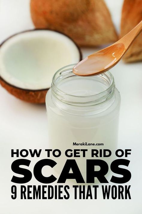 Get Rid Of Scars, Acne Scar Remedies, Getting Rid Of Scars, Scar Remedies, Lighten Scars, Oils For Scars, How To Fade, Natural Acne Remedies, Skin Natural Remedies