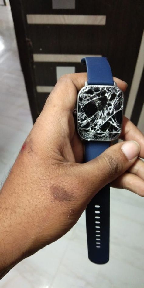 My Amazfit GTS was broken while i was travelling fromHyderabad to Kadapa in Bike Accident Fake Accident Snap Bike, Bike Accident Pictures, Bike Accident Hand Dpz, Accident Pic Of Bike, Lowkey Relationship, Lowkey Relationship Pictures, Bike Accident, Mt Bike, Profile Photography