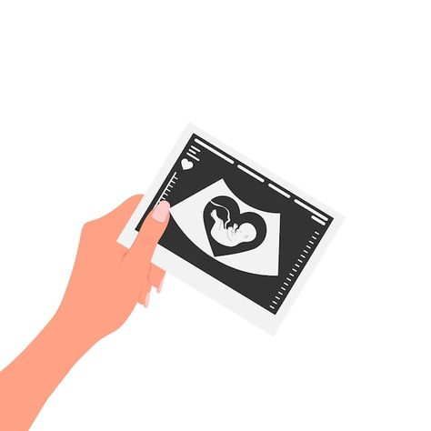 Collage Photo Frame Design, Pregnancy Images, Pregnancy Illustration, Pregnancy Affirmations, Best Camera For Photography, Iphone Wallpaper Bts, Baby Ultrasound, Baby Announcement Pictures, Hot Wheels Garage