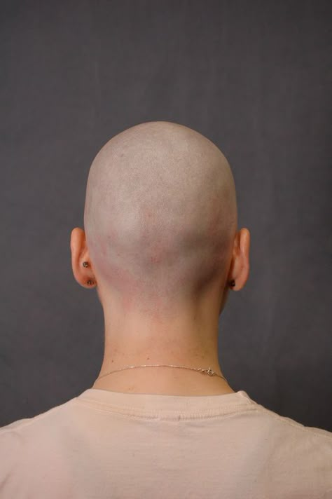 Bald Head Drawing, Heads In Different Angles, Head Back View, Female Portrait Reference, Practice Drawing Faces, Bald Person, Head References, Head Memes, Skin Anatomy