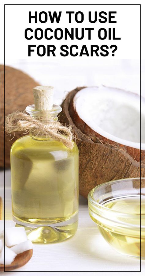 Does Coconut oil Help with Scars And How To Use It? Stretch Mark Cream Pregnancy, Whipped Coconut Oil, Doterra Oils Recipes, Oils For Scars, Homemade Beauty Recipes, Scar Removal Cream, Scar Cream, Sick Remedies, Coconut Oil Uses