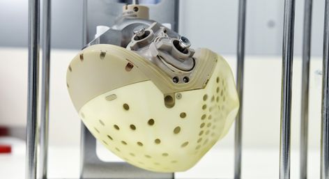 Most Advanced Artificial Heart Approved For Sale in Europe, Raising Hopes for Those Awaiting Transplants! https://www.goodnewsnetwork.org/carmats-artificial-heart-to-be-available-for-purchase-in-2021/ Artificial Heart, Normal Heart, Resume Work, Urdu News, Human Heart, Style Sport, Plastic Laundry Basket, Amazing Facts, Science Technology