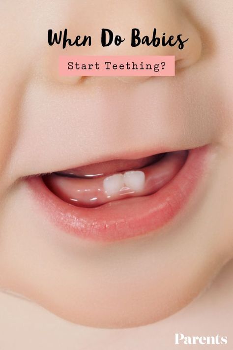 Smile Tips, Teething Symptoms, Dental Photos, Longevity Diet, Dental Videos, Kids Teeth, Beautiful Teeth, Web Stories, Tooth Sensitivity