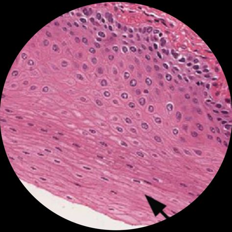 can see multiple cells squished together in multiple layers. located on the skin Squamous Epithelium, Stratified Squamous Epithelium, Anatomy And Physiology, The Skin, Anatomy, Canning, Skin