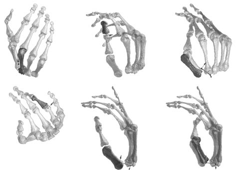 hand bones for homework Hand Bones Reference, Skeletal Hand Reference, Hand Bones Drawing, Skeleton Hand Reference, Skeleton Hand Poses, Hand Bone Anatomy, Skeleton Art Drawing, Finger Bones, Hand Bones