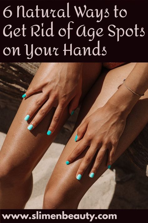 6 Natural Ways to Get Rid of Age Spots on Your Hands Age Spots Essential Oils, Get Rid Of Age Spots, Brown Spots On Hands, Get Rid Of Spots, Age Spots On Face, Brown Age Spots, Longevity Diet, Brown Spots On Skin, Dark Spots On Skin