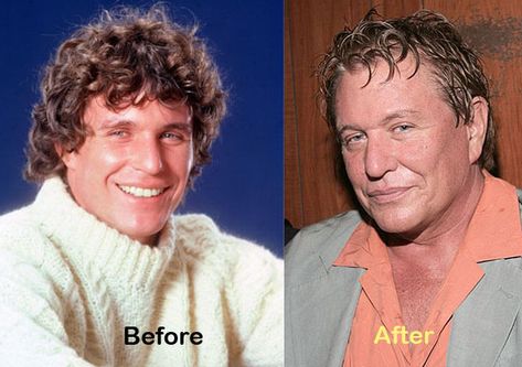 Tom Berenger, Actors Then And Now, Celebrity Plastic Surgery, Celebrities Then And Now, Young Celebrities, Celebrities Before And After, Stars Then And Now, Musical Group, Aging Well