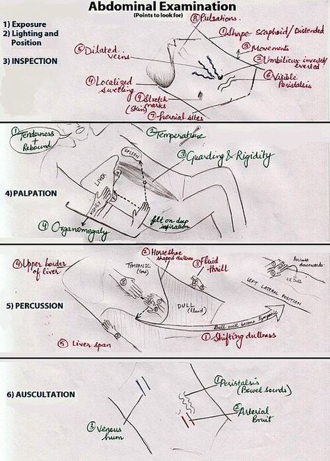 Abdominal assessment Abdominal Examination, Rovsing's Sign, Quadrants Of The Abdomen, Physician Assistant Student, Gi System, Mcat Study, Physical Examination, Nursing Mnemonics, Medical Student Study